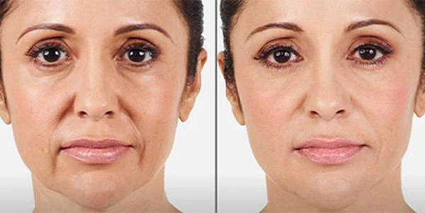 Beforeafter Stemnucell