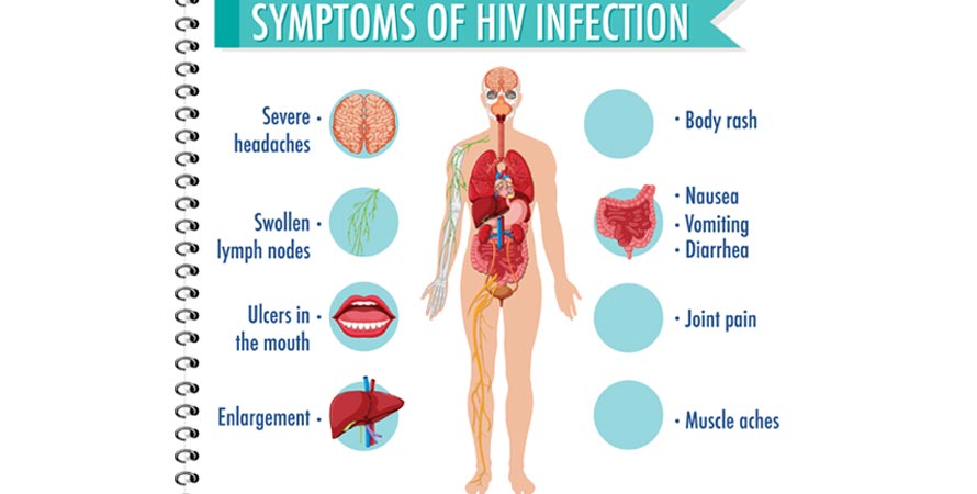 Common Symptoms of AIDS