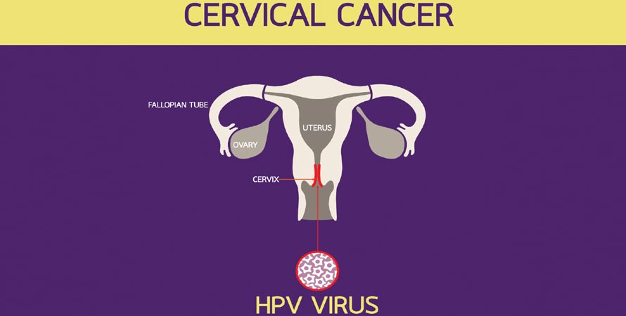 Cervical Health Awareness