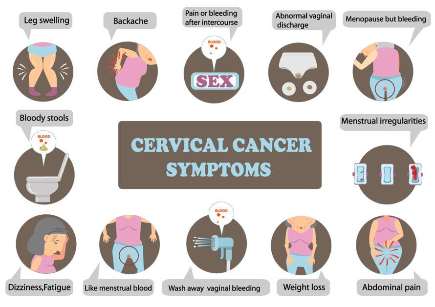 Symptoms of cervical cancer