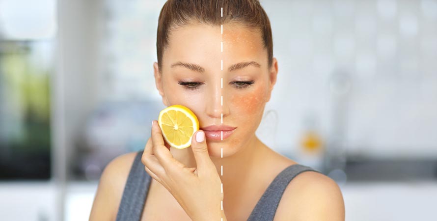 Get Rid Of Tan On The Skin