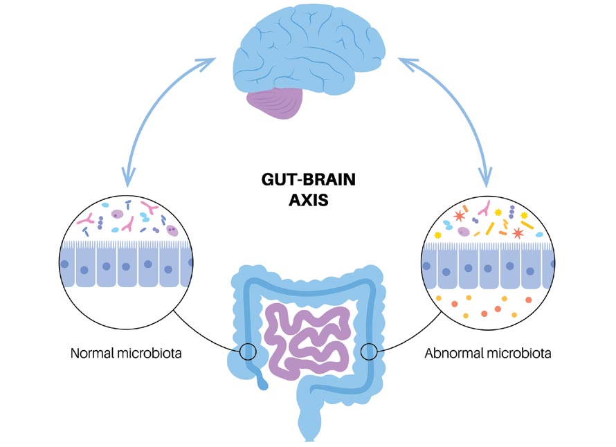 Gut-brain axis