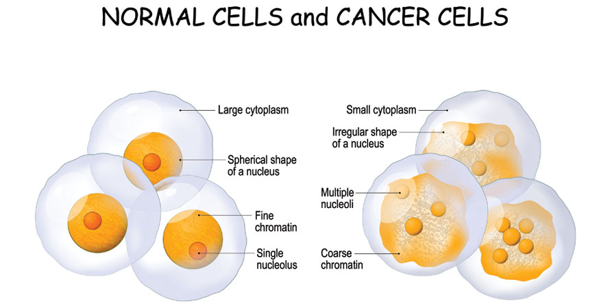 Cancer Cells