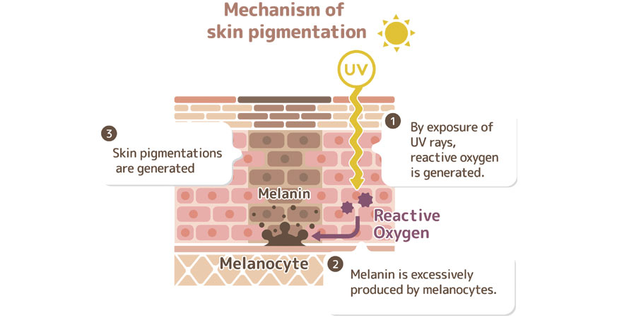 Skin Pigmentation