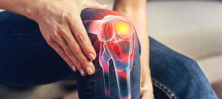 Synovitis Knee