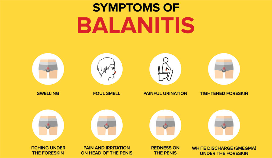 symptoms of balanitis