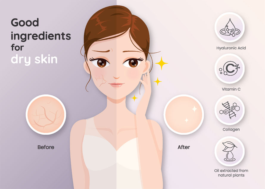 Moisturizer for dry skin