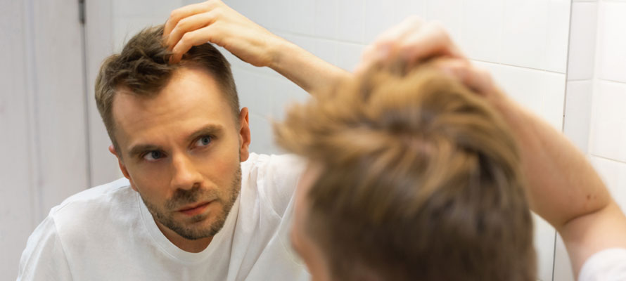 Early Signs of Balding