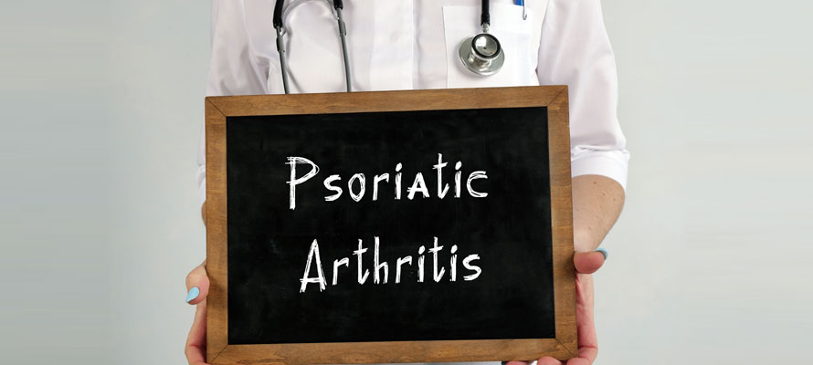Psoriatic Arthritis