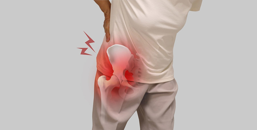 Hip Joint Pain When Walking – Mobility Discomfort Illustration