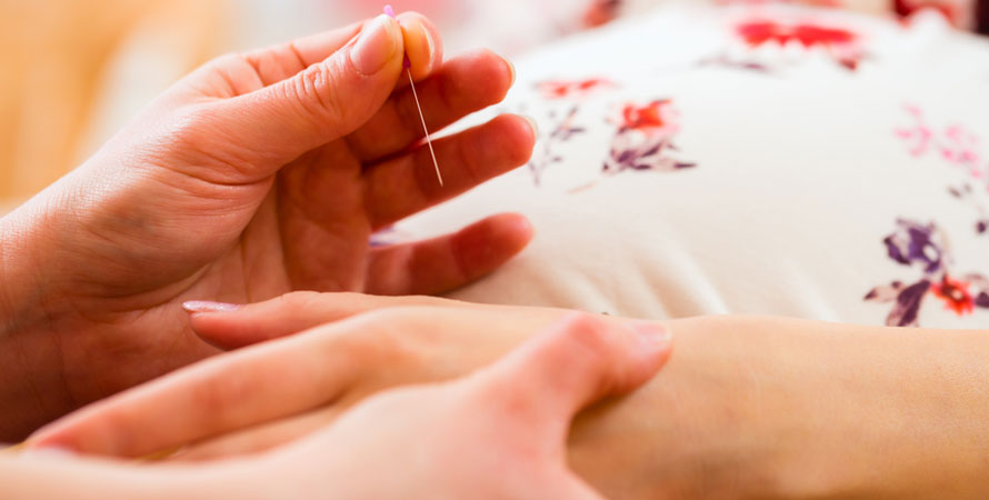 Acupuncture for fertility