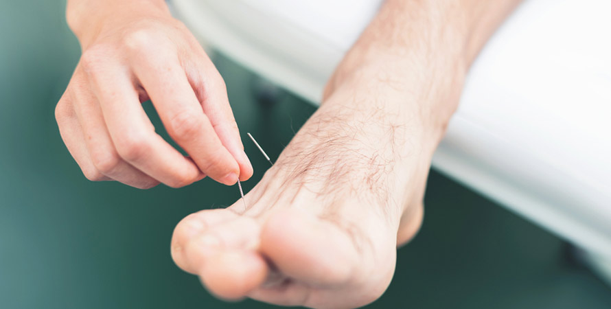 Arm Stabbing Acupuncture