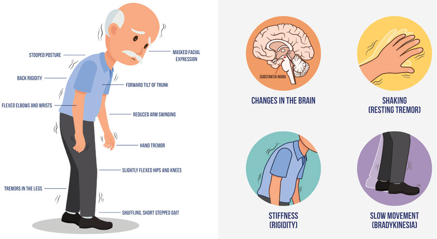 Parkinson's patients
